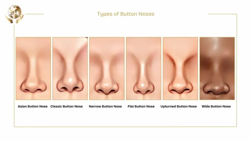 Button Nose Types 1 Types-of-Button-Noses